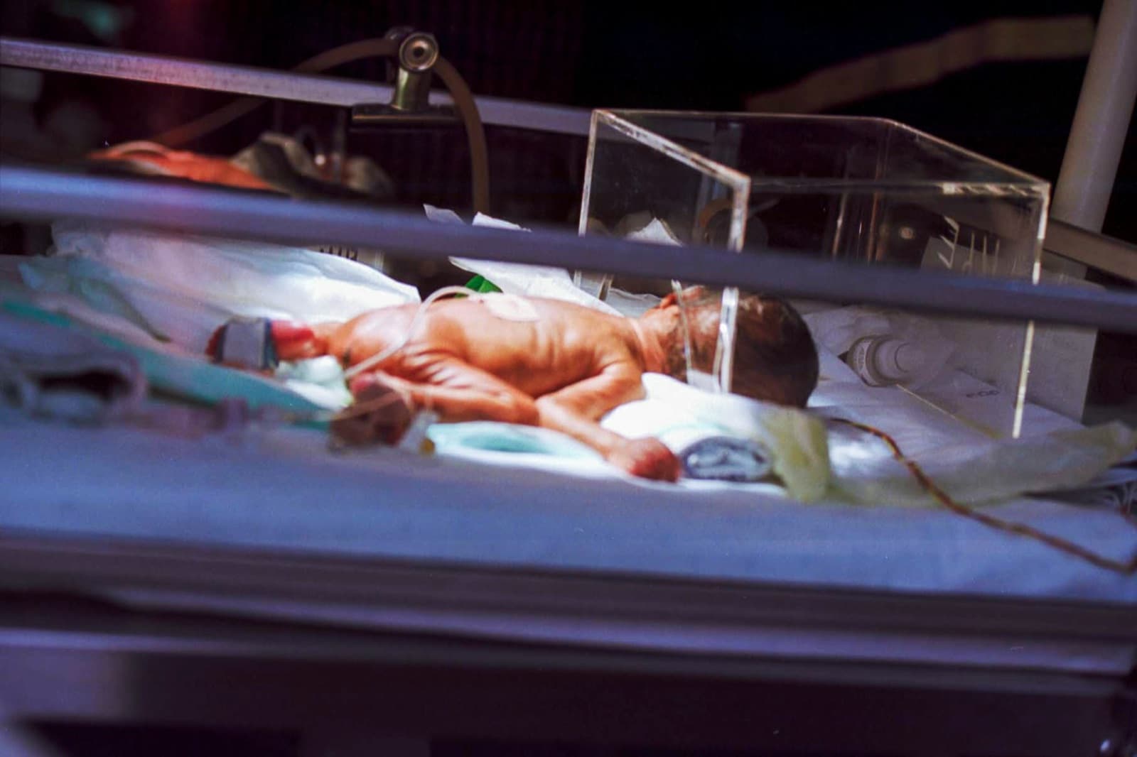 A newborn in a NICU bassinet under cool clinical light, surrounded by monitoring equipment